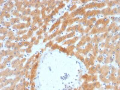 Immunohistochemistry-Paraffin: ARF1 Antibody (ARF1/2117) - Azide and BSA Free [NBP3-08473]