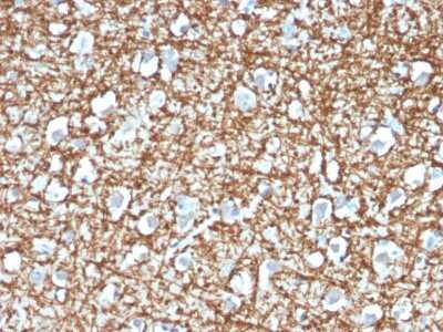 Immunohistochemistry-Paraffin: ARF1 Antibody (ARF1/2117) - Azide and BSA Free [NBP3-08473]
