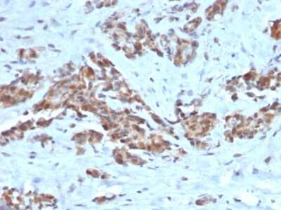 Immunohistochemistry-Paraffin: ARF1 Antibody (ARF1/2117) - Azide and BSA Free [NBP3-08473]