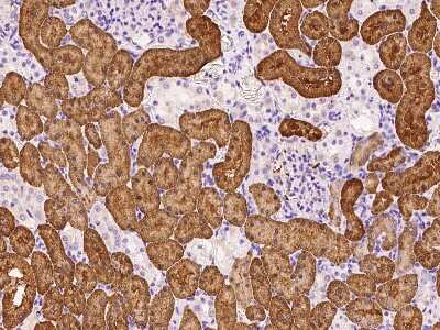 Immunohistochemistry-Paraffin: ARF3 Antibody [NBP2-99493]