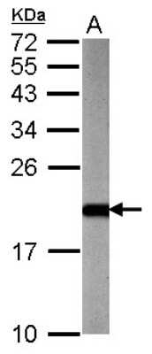 Western Blot: ARF3 Antibody [NBP2-15439]
