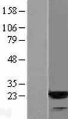 Western Blot: ARF3 Overexpression Lysate [NBL1-07651]