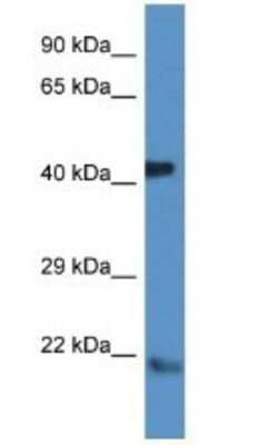 Western Blot: ARF4 Antibody [NBP1-79614]