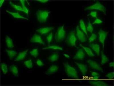 Immunocytochemistry/ Immunofluorescence: ARF5 Antibody (1B4) [H00000381-M01]
