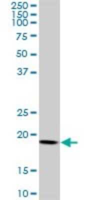 Western Blot: ARF5 Antibody (1B4) [H00000381-M01]