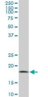 Western Blot: ARF5 Antibody (1B4) [H00000381-M01]