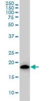 Western Blot: ARF5 Antibody (1B4) [H00000381-M01]