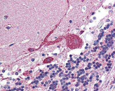 Immunohistochemistry-Paraffin: ARF6 Antibody [NBP1-58310]