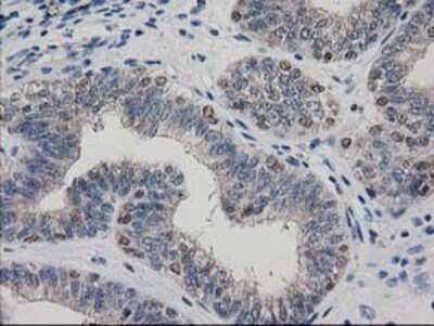 Immunohistochemistry-Paraffin: ARFGAP1 Antibody (OTI1F6) [NBP2-00513]