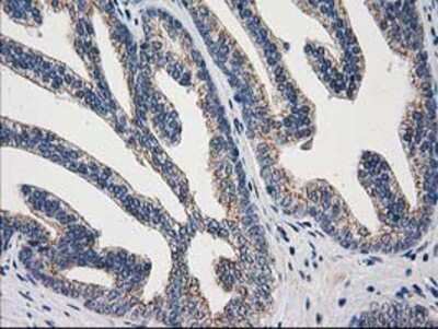 Immunohistochemistry-Paraffin: ARFGAP1 Antibody (OTI1F6) [NBP2-00513]
