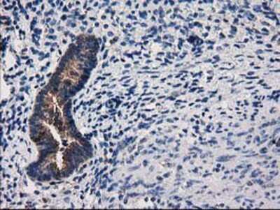 Immunohistochemistry-Paraffin: ARFGAP1 Antibody (OTI1F6) [NBP2-00513]