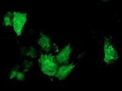 Immunocytochemistry/ Immunofluorescence: ARFGAP1 Antibody (OTI1F6) - Azide and BSA Free [NBP2-72013]