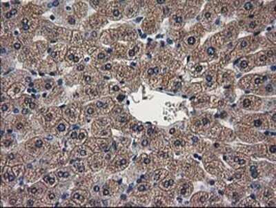 Immunohistochemistry: ARFGAP1 Antibody (OTI1F6) - Azide and BSA Free [NBP2-72013]