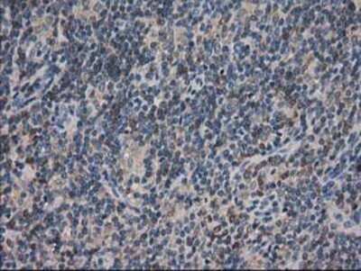 Immunohistochemistry: ARFGAP1 Antibody (OTI1F6) - Azide and BSA Free [NBP2-72013]