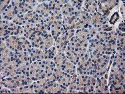 Immunohistochemistry: ARFGAP1 Antibody (OTI1F6) - Azide and BSA Free [NBP2-72013]