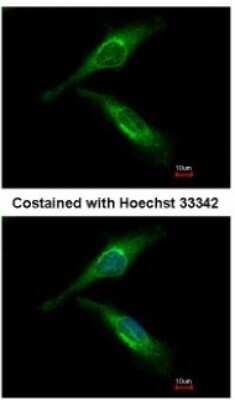 Immunocytochemistry/ Immunofluorescence: ARFGAP2 Antibody [NBP2-15441]