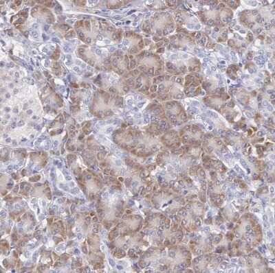 Immunohistochemistry-Paraffin: ARFGAP3 Antibody [NBP1-88842]
