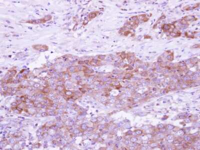 Immunohistochemistry-Paraffin: ARFGAP3 Antibody [NBP2-15443]