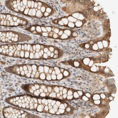 Immunohistochemistry-Paraffin: ARFGEF1 Antibody [NBP1-88841]