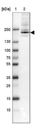 Western Blot: ARFGEF1 Antibody [NBP1-88840]