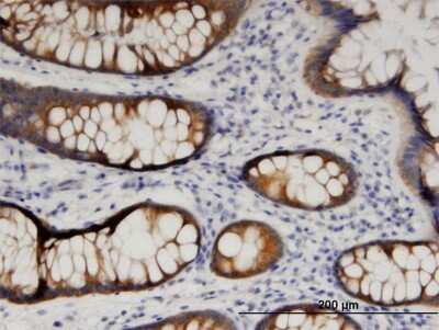 Immunohistochemistry-Paraffin: ARFIP1 Antibody (1F10) [H00027236-M05]