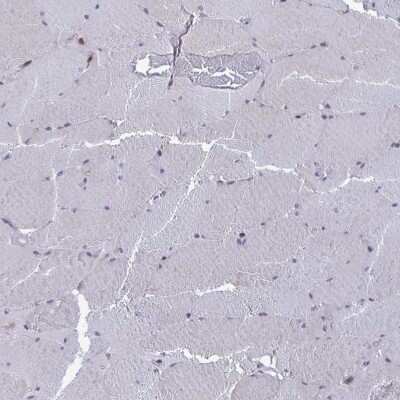 Immunohistochemistry-Paraffin: ARFIP1 Antibody [NBP2-39002]
