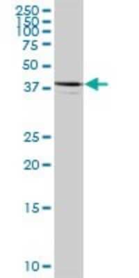 Western Blot: ARFIP1 Antibody [H00027236-B01P]
