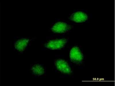 Immunocytochemistry/ Immunofluorescence: ARFIP2 Antibody [H00023647-B01P]