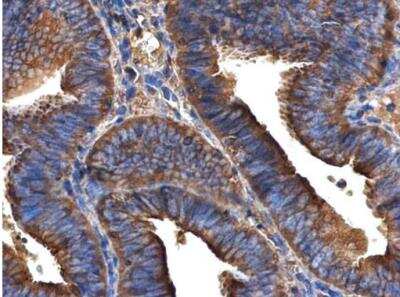 Immunohistochemistry-Paraffin: ARFIP2 Antibody [NBP1-33195]