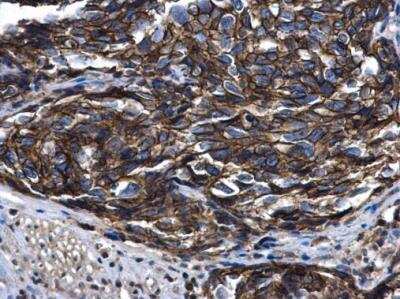Immunohistochemistry-Paraffin: ARFIP2 Antibody [NBP1-33195]
