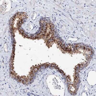 Immunohistochemistry-Paraffin: ARFIP2 Antibody [NBP1-87255]