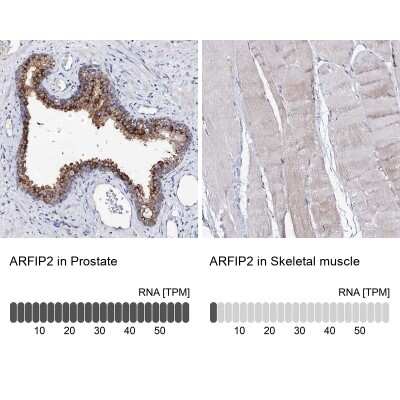 Immunohistochemistry-Paraffin: ARFIP2 Antibody [NBP1-87255]