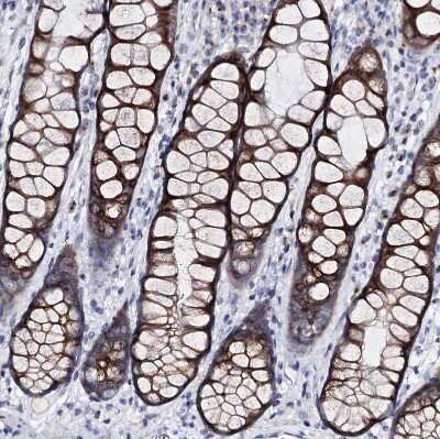 Immunohistochemistry-Paraffin: ARFIP2 Antibody [NBP1-87255]