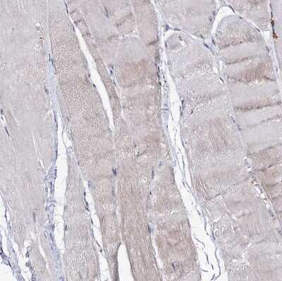 Immunohistochemistry-Paraffin: ARFIP2 Antibody [NBP1-87255]