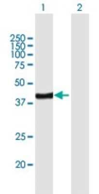 Western Blot: ARFIP2 Antibody [H00023647-B01P]