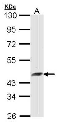Western Blot: ARFIP2 Antibody [NBP1-33195]