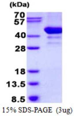 SDS-PAGE: Recombinant Human ARFIP2 His Protein [NBP2-22679]