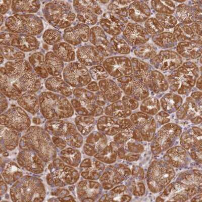 Immunohistochemistry-Paraffin: ARFRP1 Antibody [NBP2-14306]