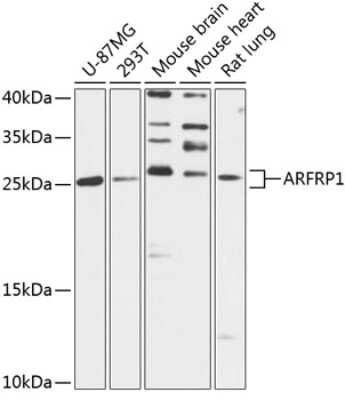 Western Blot: ARFRP1 AntibodyAzide and BSA Free [NBP2-92150]