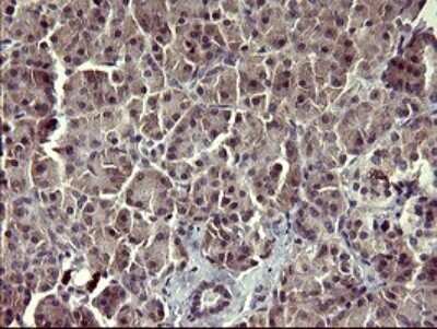 Immunohistochemistry: ARG2 Antibody (OTI3G5) [NBP2-46539]