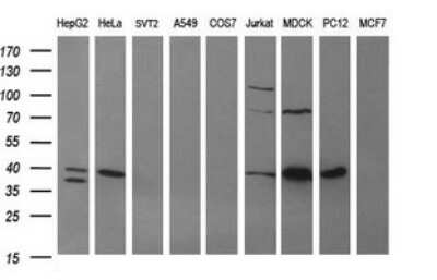 Western Blot: ARG2 Antibody (OTI3G5) [NBP2-46539]