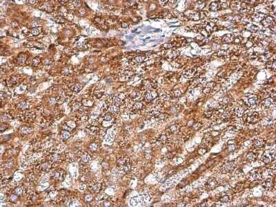 Immunohistochemistry-Paraffin: ARG2 Antibody (GT11111) [NBP3-13616]
