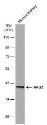 Western Blot: ARG2 Antibody (GT11111) [NBP3-13616]
