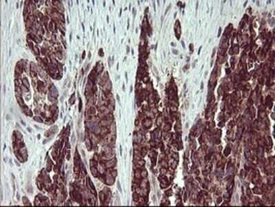 Immunohistochemistry: ARG2 Antibody (OTI3G5) - Azide and BSA Free [NBP2-70205]
