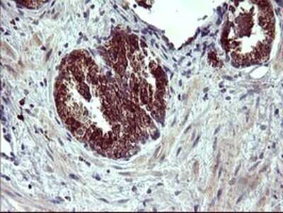 Immunohistochemistry: ARG2 Antibody (OTI3G5) - Azide and BSA Free [NBP2-70205]