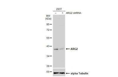 Western Blot: ARG2 Antibody [NBP2-15445]