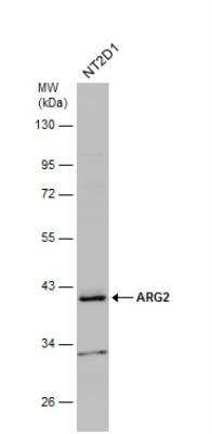 Western Blot: ARG2 Antibody [NBP2-15446]