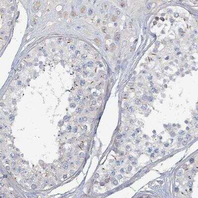 Immunohistochemistry-Paraffin: ARGFX Antibody [NBP2-14307]