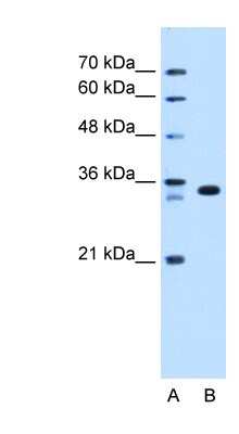 Western Blot: ARGFX Antibody [NBP1-79220]