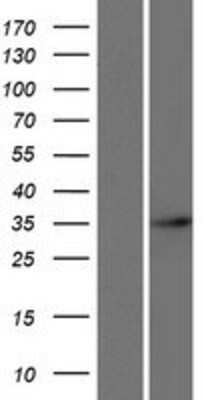 Western Blot: ARGFX Overexpression Lysate [NBP2-08701]